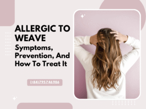 Allergic To Weave: Symptoms, Prevention, And How To Treat It
