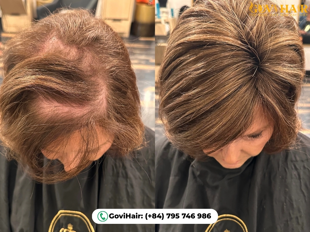 Hair toppers before and after