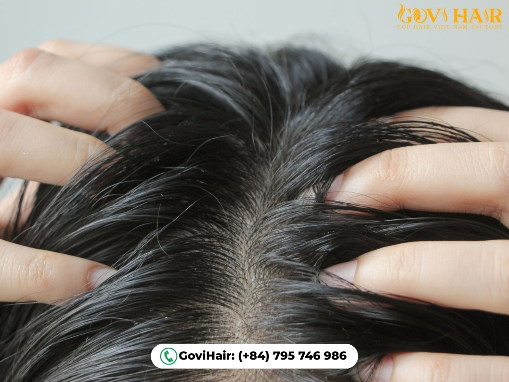 Quick weave hairstyle causing scalp dryness itch