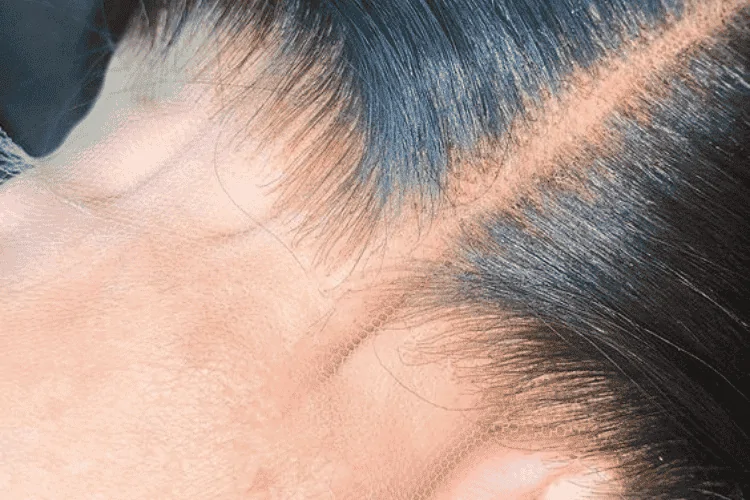 Steps to Removing transparent and HD lace wigs Steps to Removing transparent and HD lace wigs