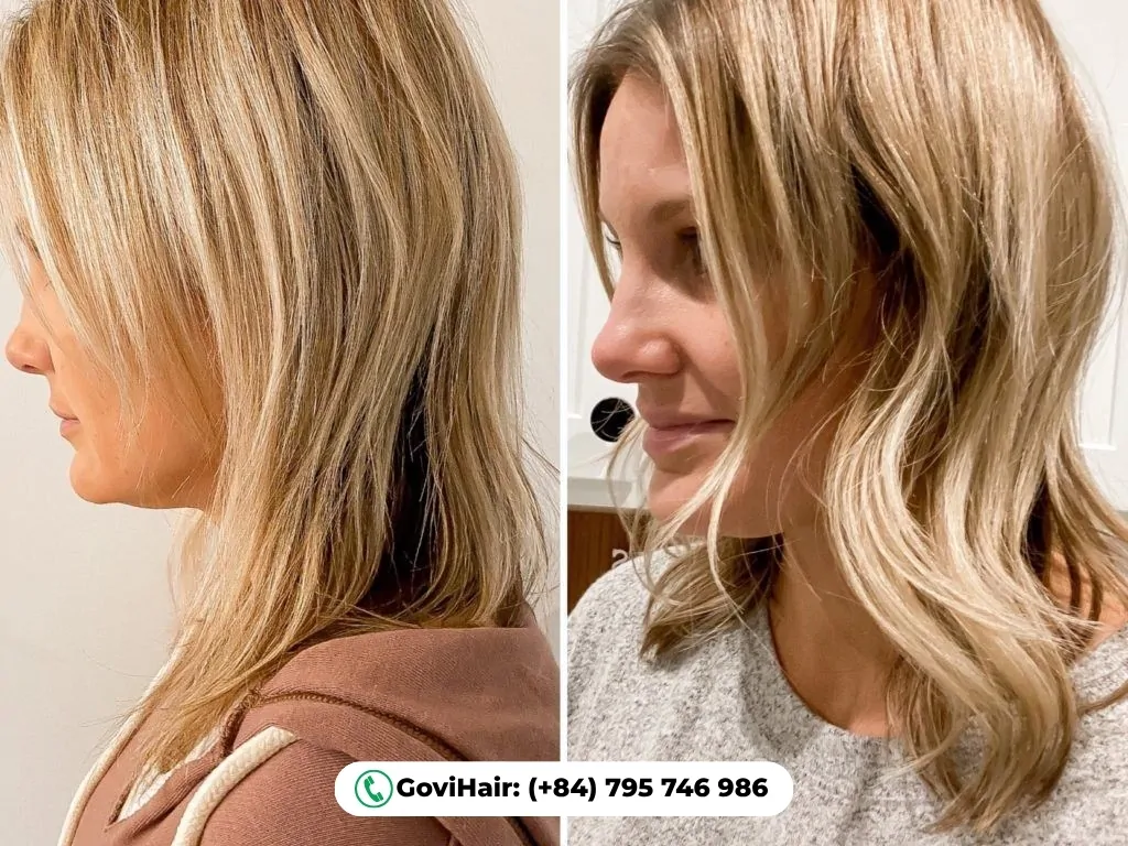 Major Concerns That Can Cause Hair Damage