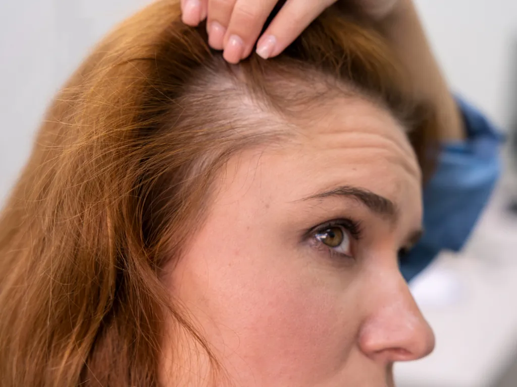 Primarily causing allergic contact dermatitis Can hair dye harm the skin?
